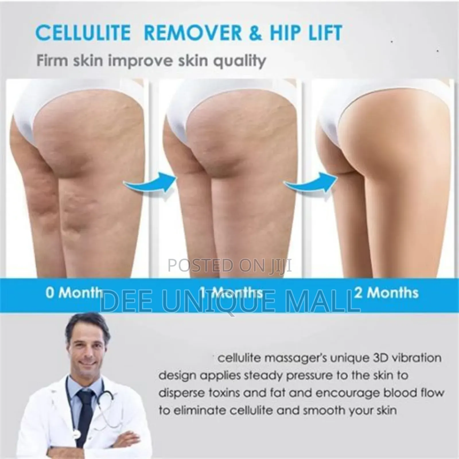 Anti-cellulite & Stretch Marks Electric Body Sculpt Massager