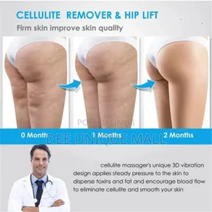 Anti-cellulite & Stretch Marks Electric Body Sculpt Massager