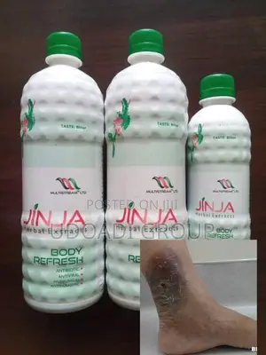 Jinja Heals Leg Ulcers
