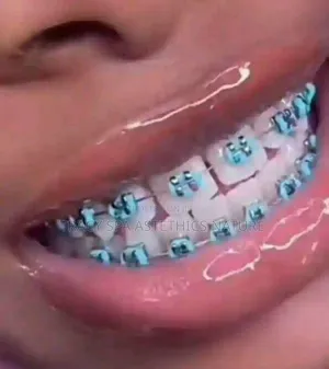 Fashion Bracess