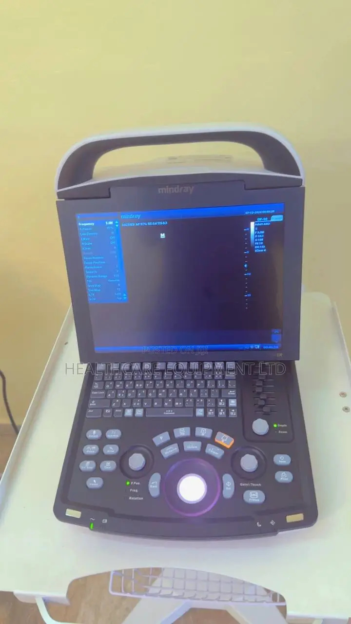 Mindray Dp-10 2d Ultrasound Machine