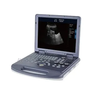 Laptop Ultrasound Machine