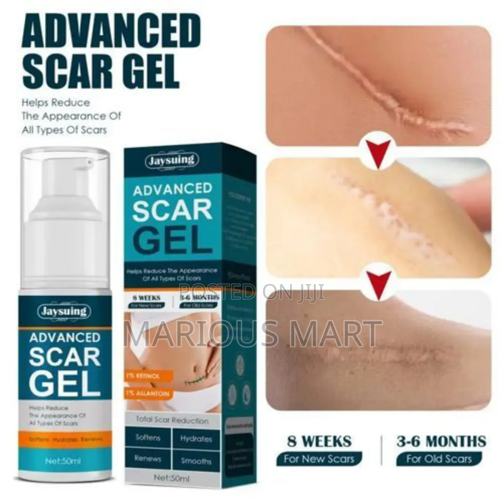 Advanced Scar Removal Cream