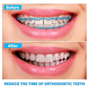 Orthodontic Power Chain