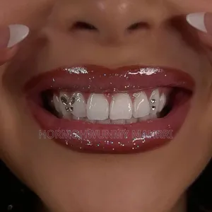 Tooth Gem Fixing
