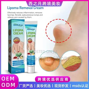 Lipoma Removal/Relief Cream