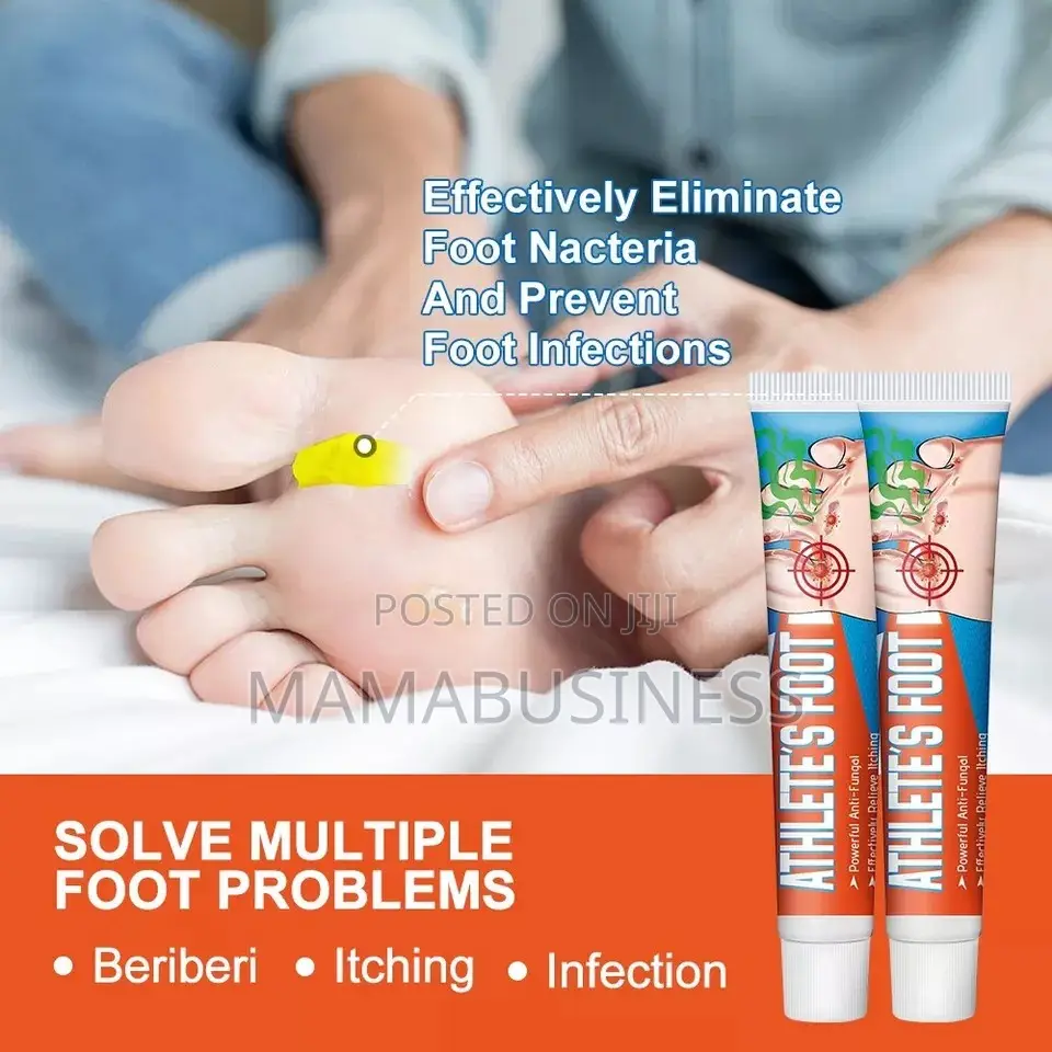 Sumifun Athlete's Foot Cream - 20g