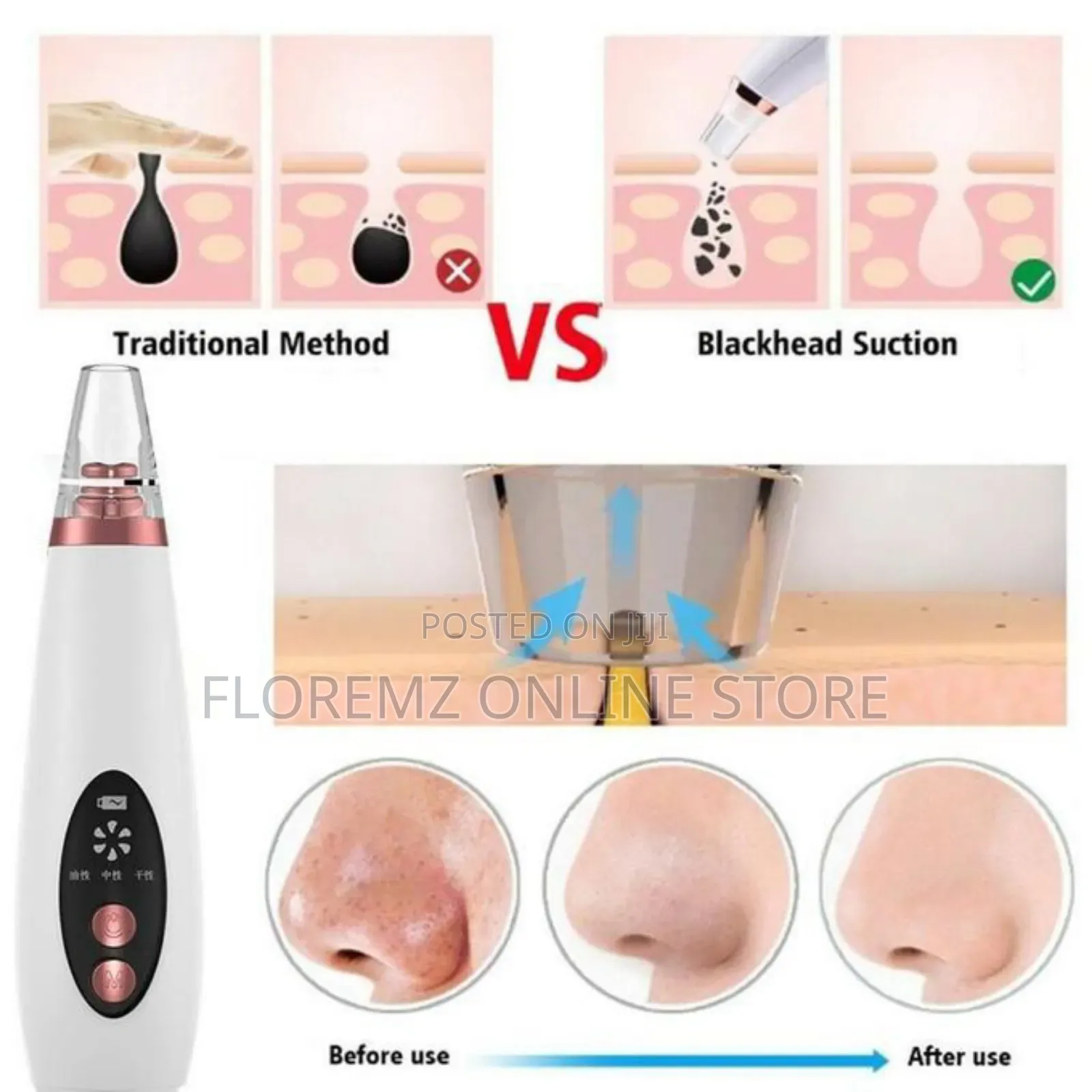 Facial Multi Functional Blackhead Pimple Extraction Device