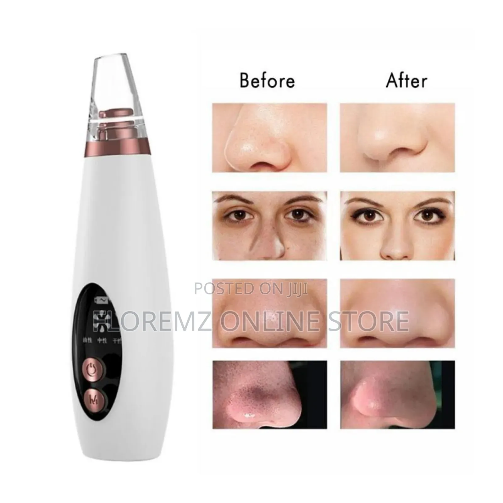 Facial Multi Functional Blackhead Pimple Extraction Device