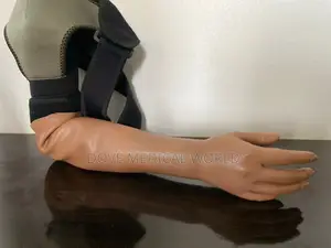 Above Elbow Prosthetic Limb