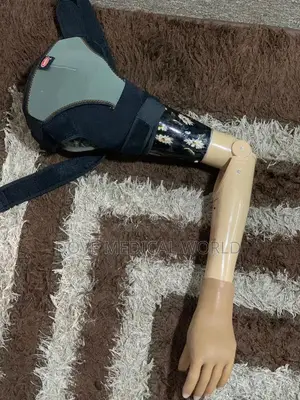 Above Elbow Prosthetic Limb Myoelectric