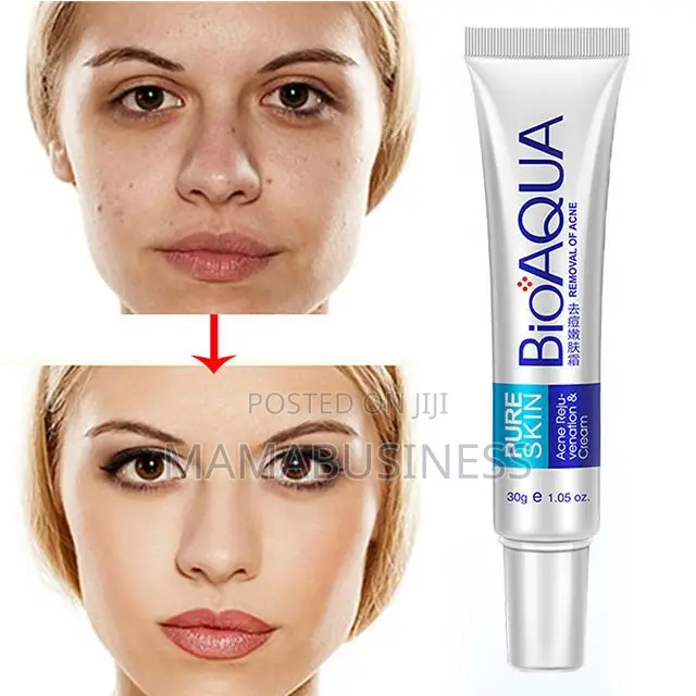 Bioaqua Acne Acne Removal Solution- 30g