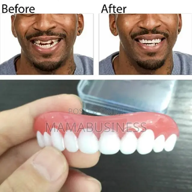 Perfect Smile Veneers Denture Teeth Cover