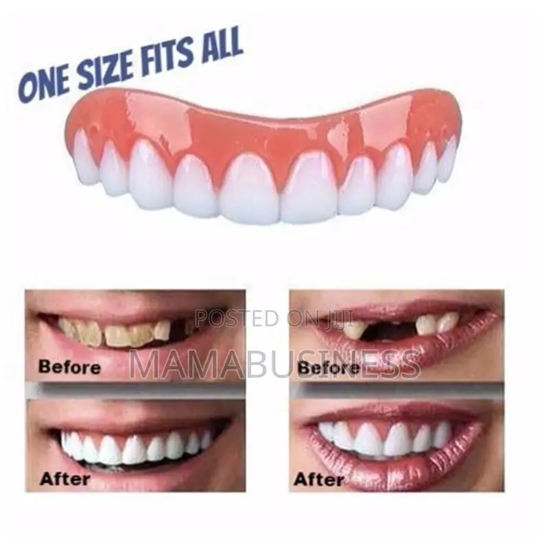 Perfect Smile Veneers Denture Teeth Cover