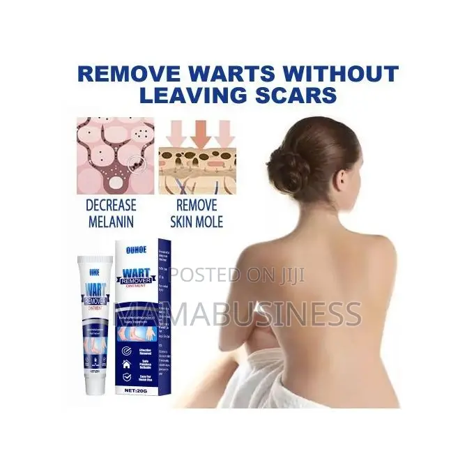 Eelhoe Wart Remover Oinment - 20g