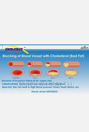 Choleduz Omega Supreme