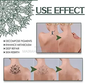 Tattoo Removal Spray (Hmk)