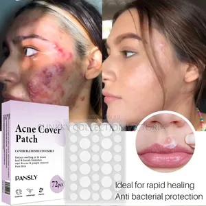 Pansly Acne Cover Patch (72pcs Packed)