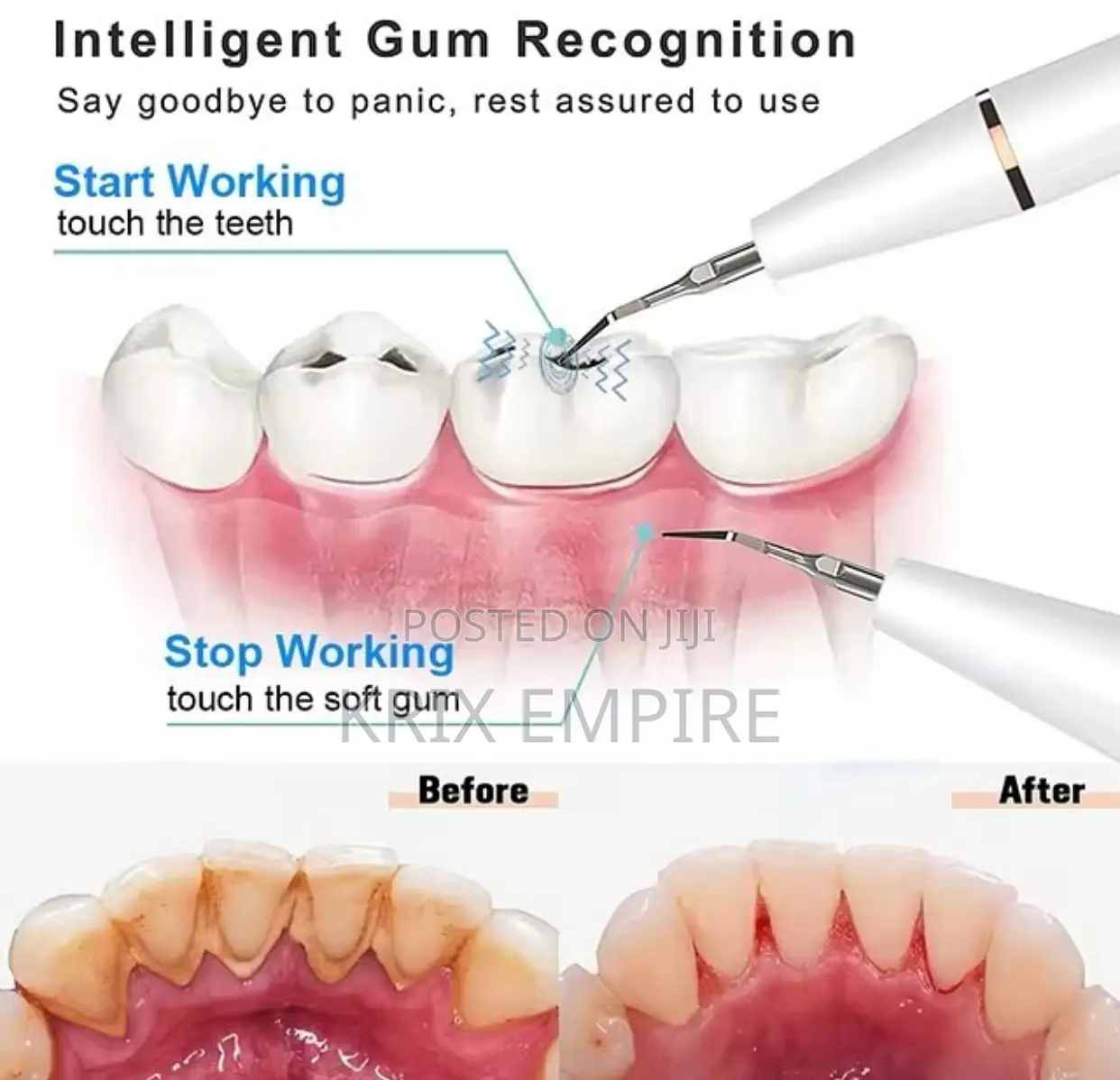 Ultrasonic Dental Scaler