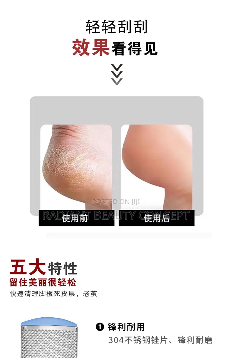 Double-Sided Callus Removal