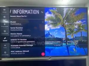 Crispy Lg 75”Inches Class Smart Uhd Tv With Ai Thinq