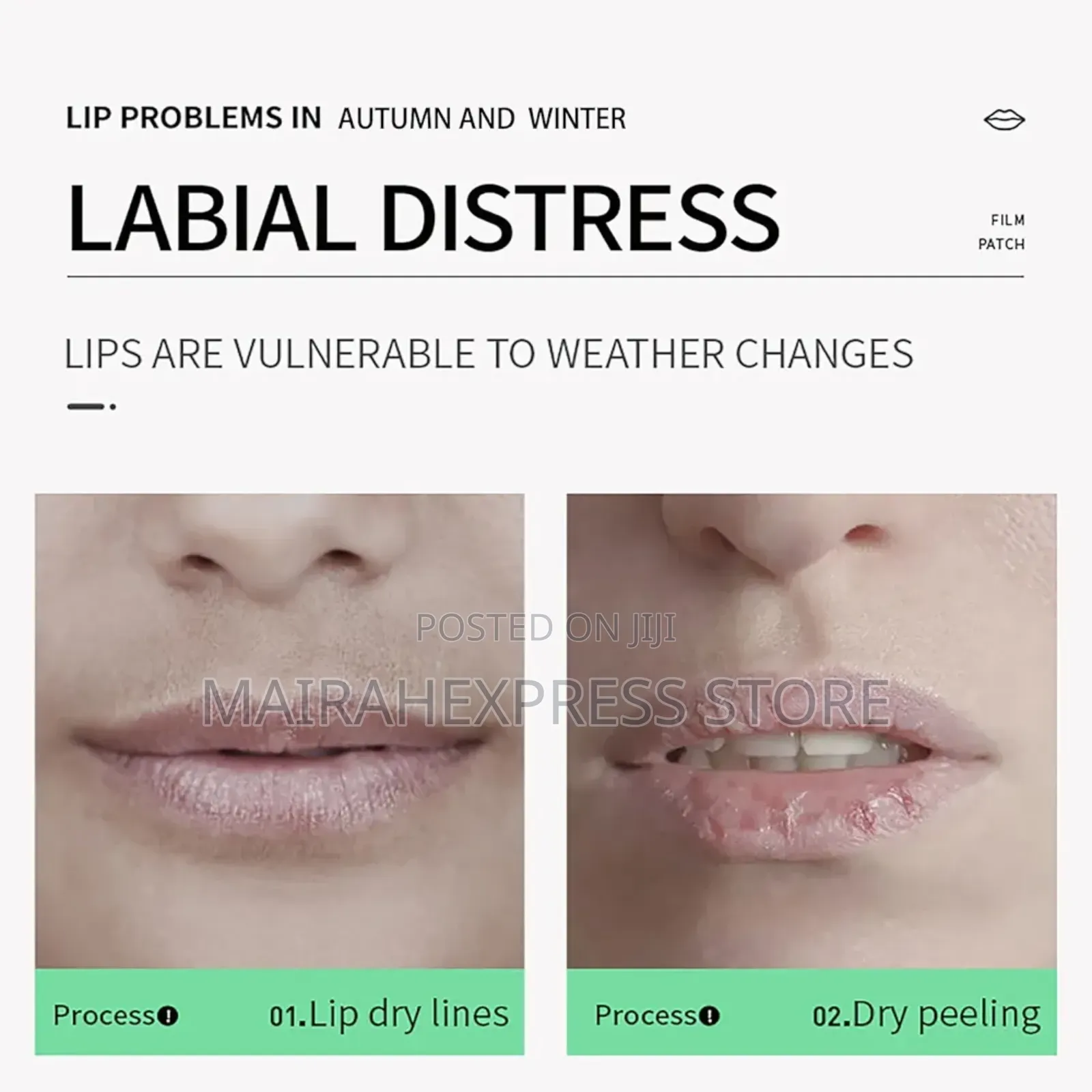 10pcs Collagen Fruit Lip Mask (Sk-hans Brand)