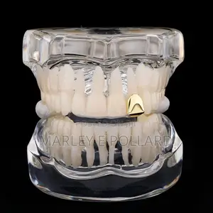 14karat Goldplated Single Tooth Teeth Grillz