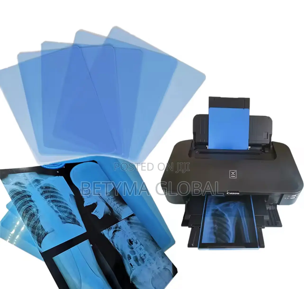“A4” Size Blue X-Ray Films for Inkjet (Canon Epson) Printers in ...