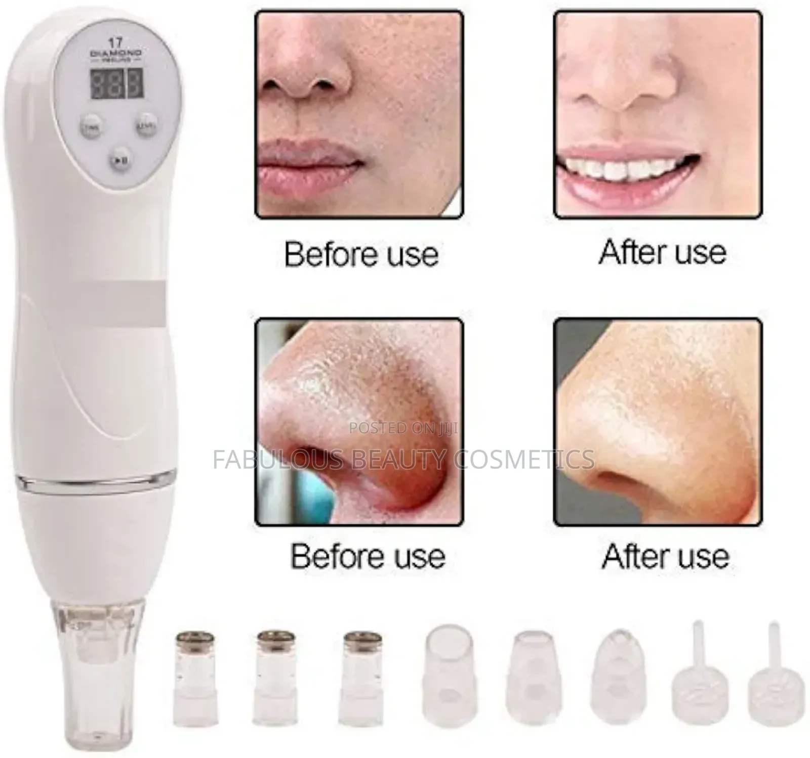 Generic Diamond Microdermabrasion Machine
