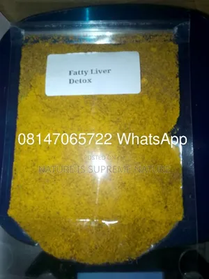 Herbs for Fatty Liver Disease