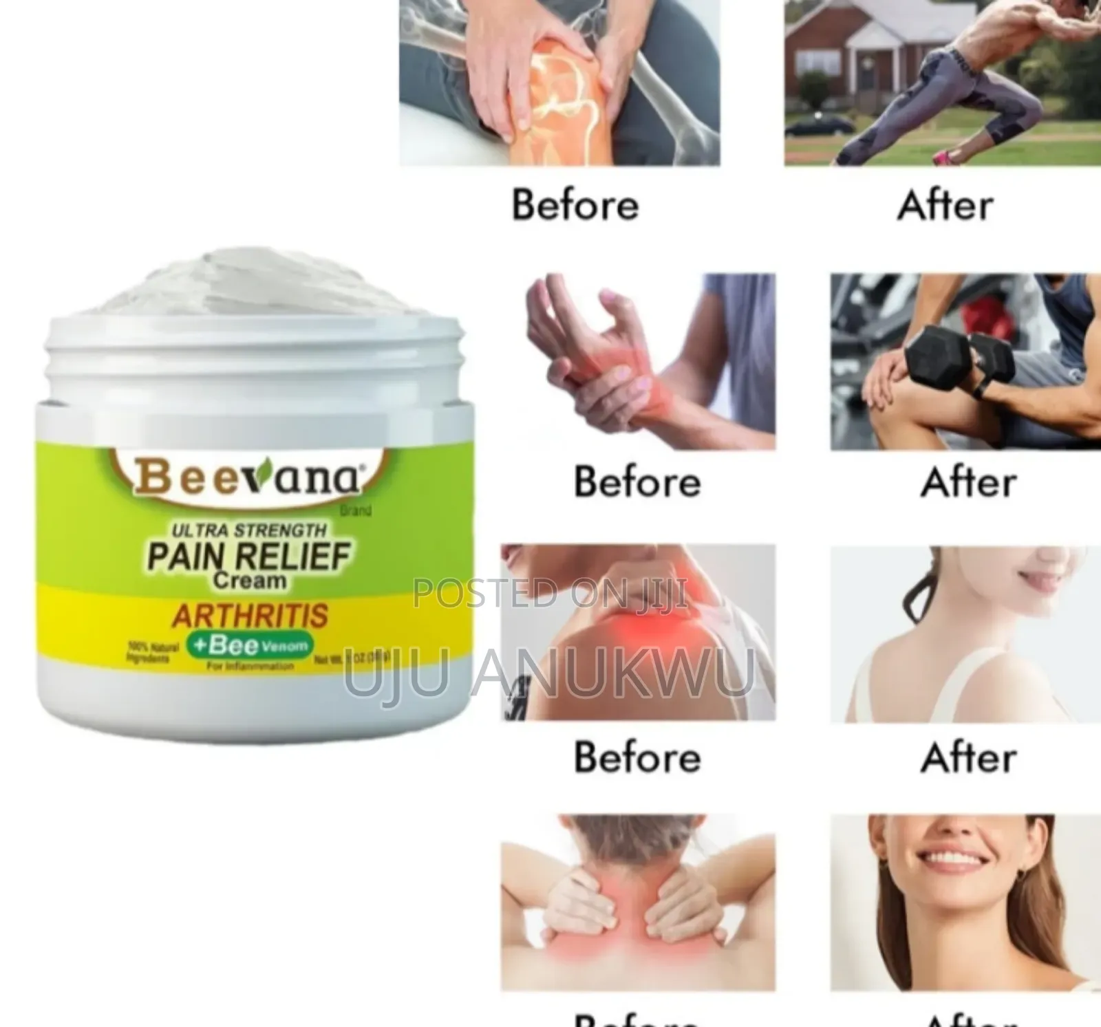 Beevana Bee Venom Joint Bone, Arthritis Cream