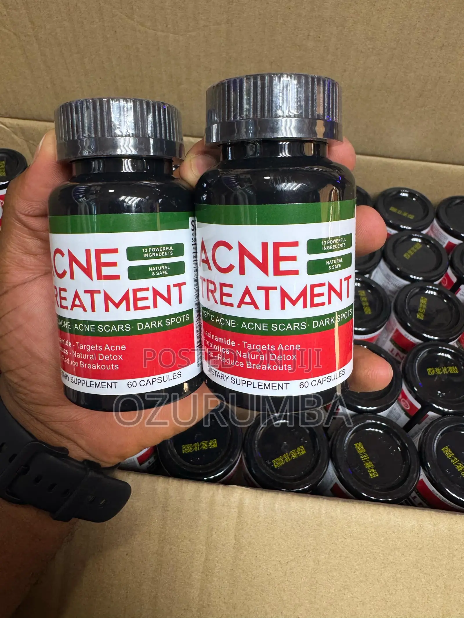 Acne Treatment