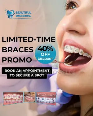 40% Discount on Braces