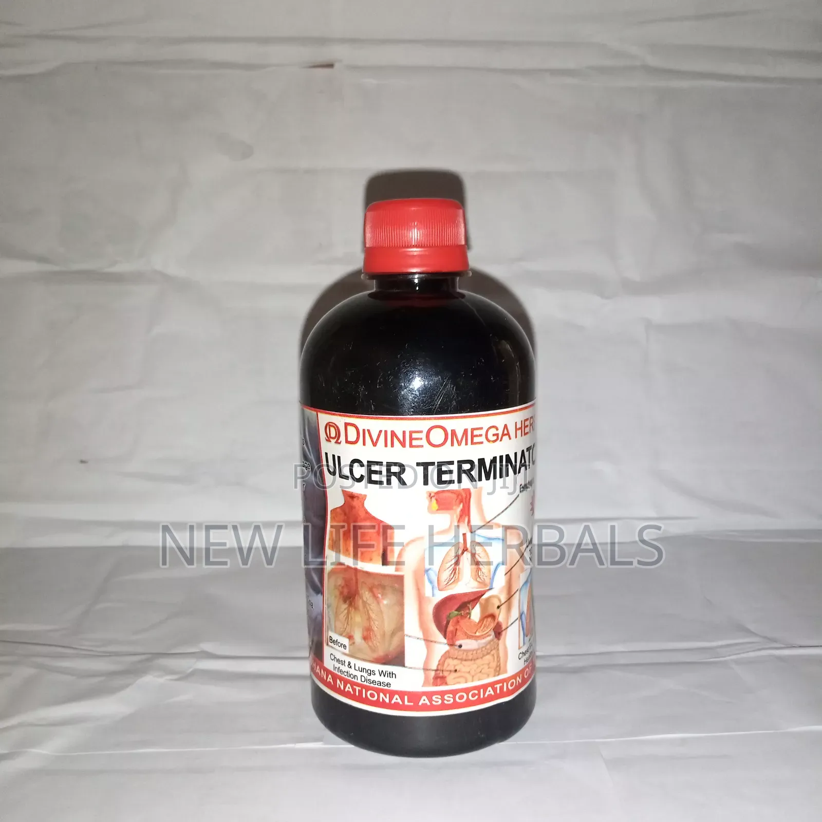 Ghanacin Ulcer Wiper