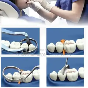 Orthodontic Dental Matrices