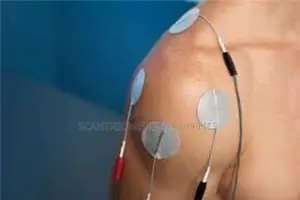 Muscle Stimulator System