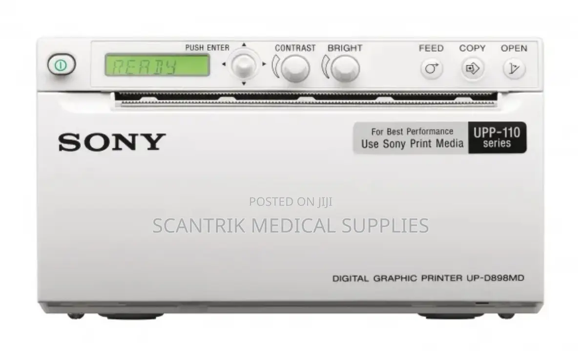 Portable Ultrasound Machine