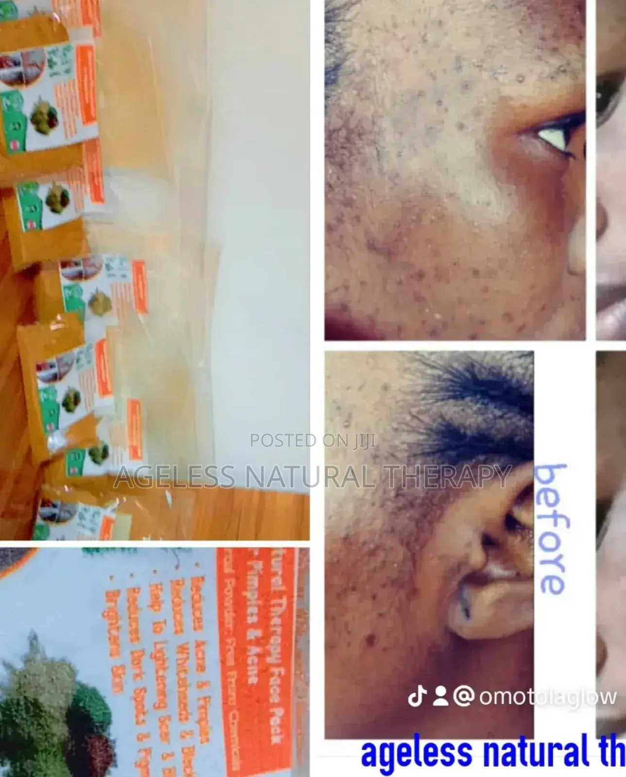 Repair Face Pack Powders for Severe Skin Blemishes