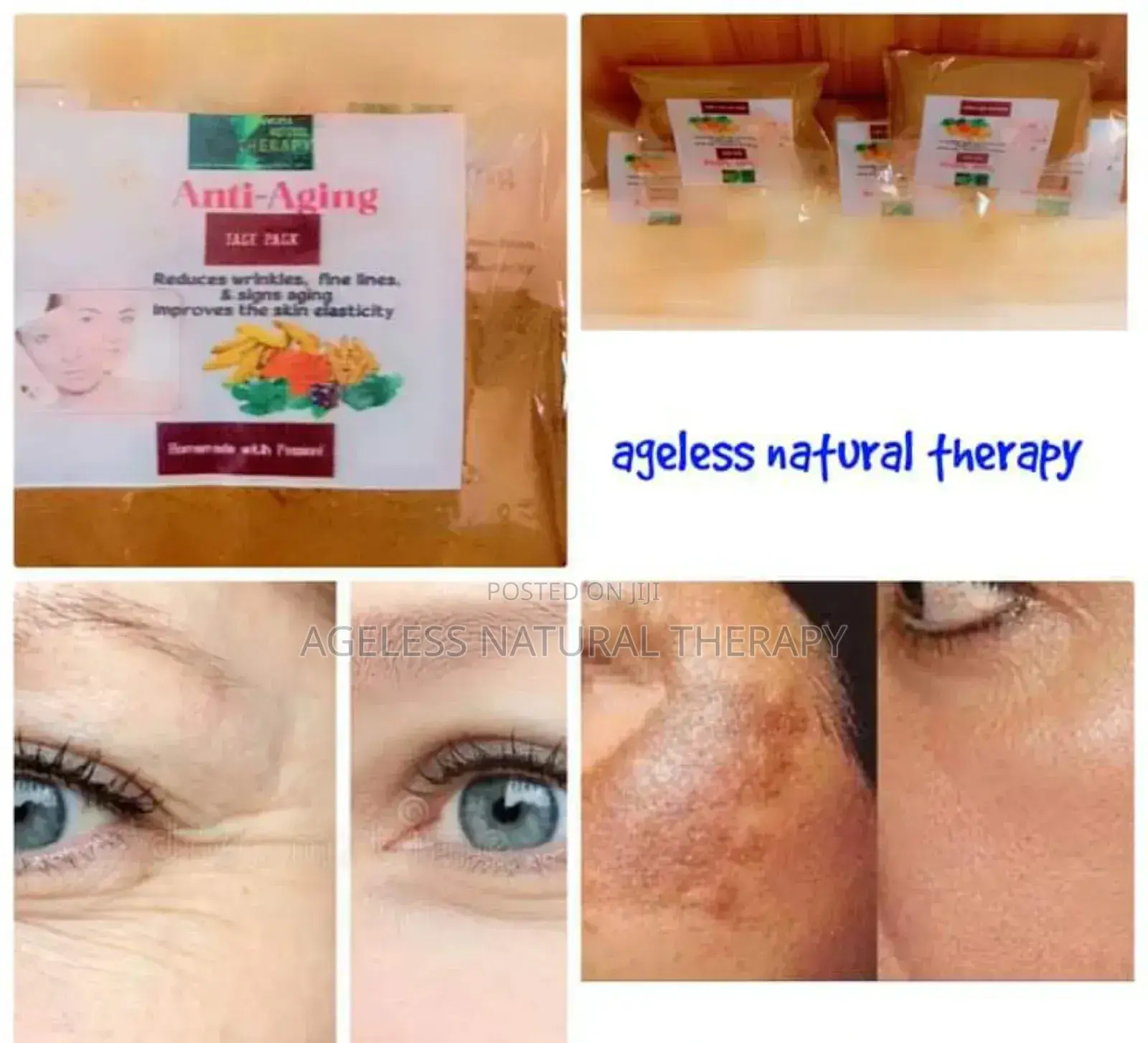 Repair Face Pack Powders for Severe Skin Blemishes