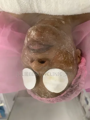 Photo - Hydra Facial Improves Ur Skin