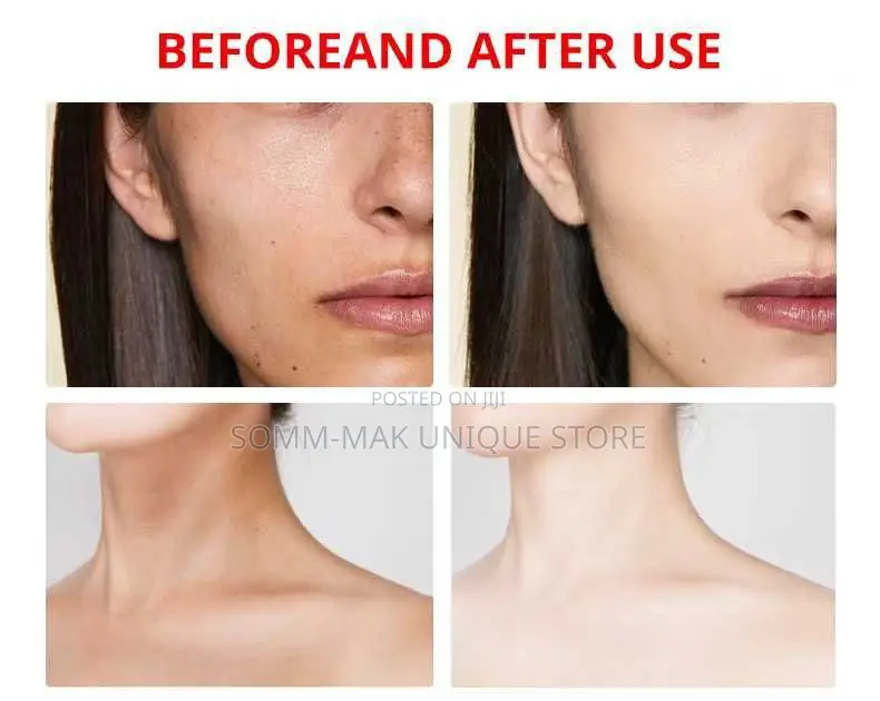 Kojic Carrot Whitening Cream
