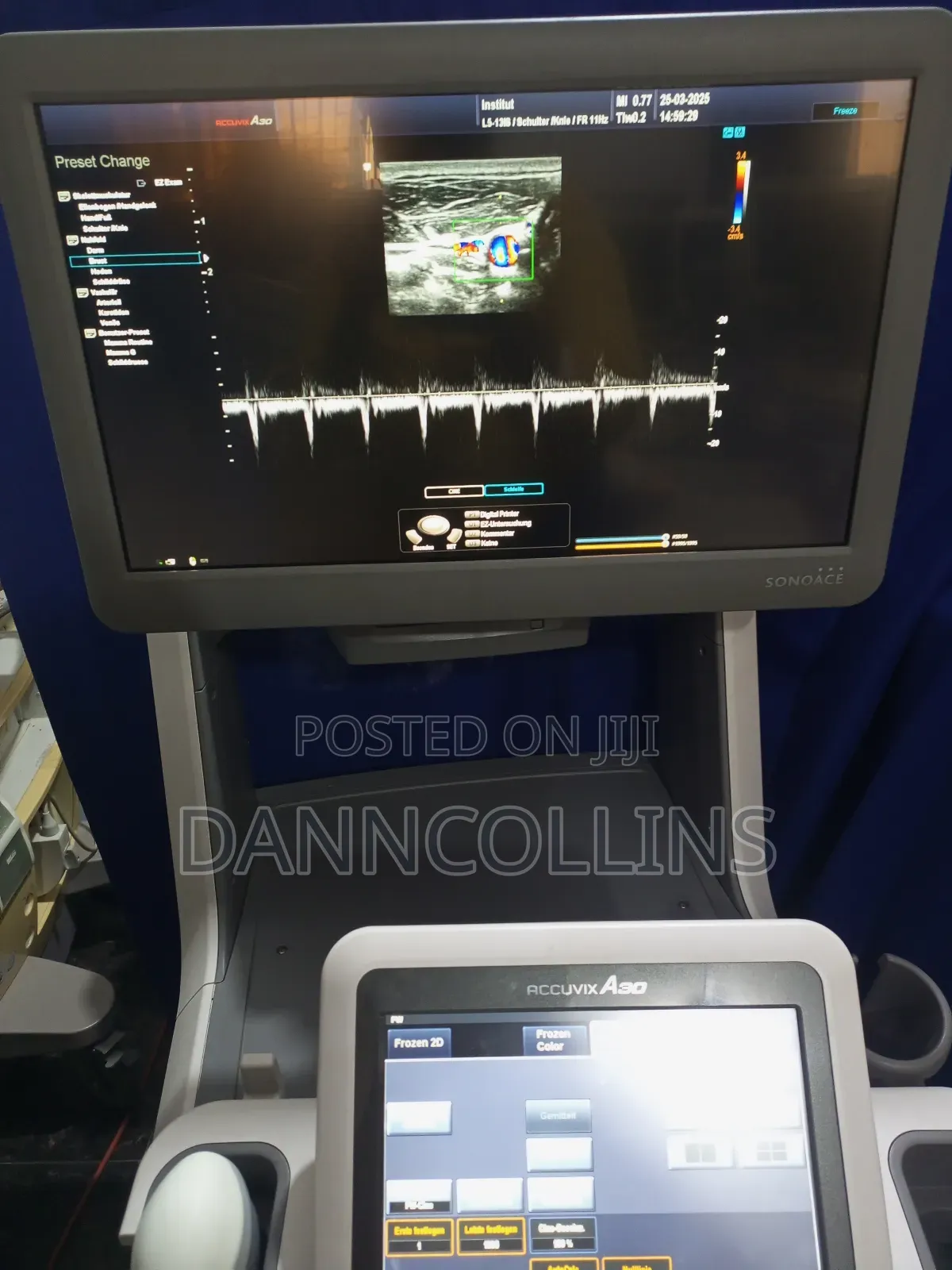 Sonoace Accuvix A30