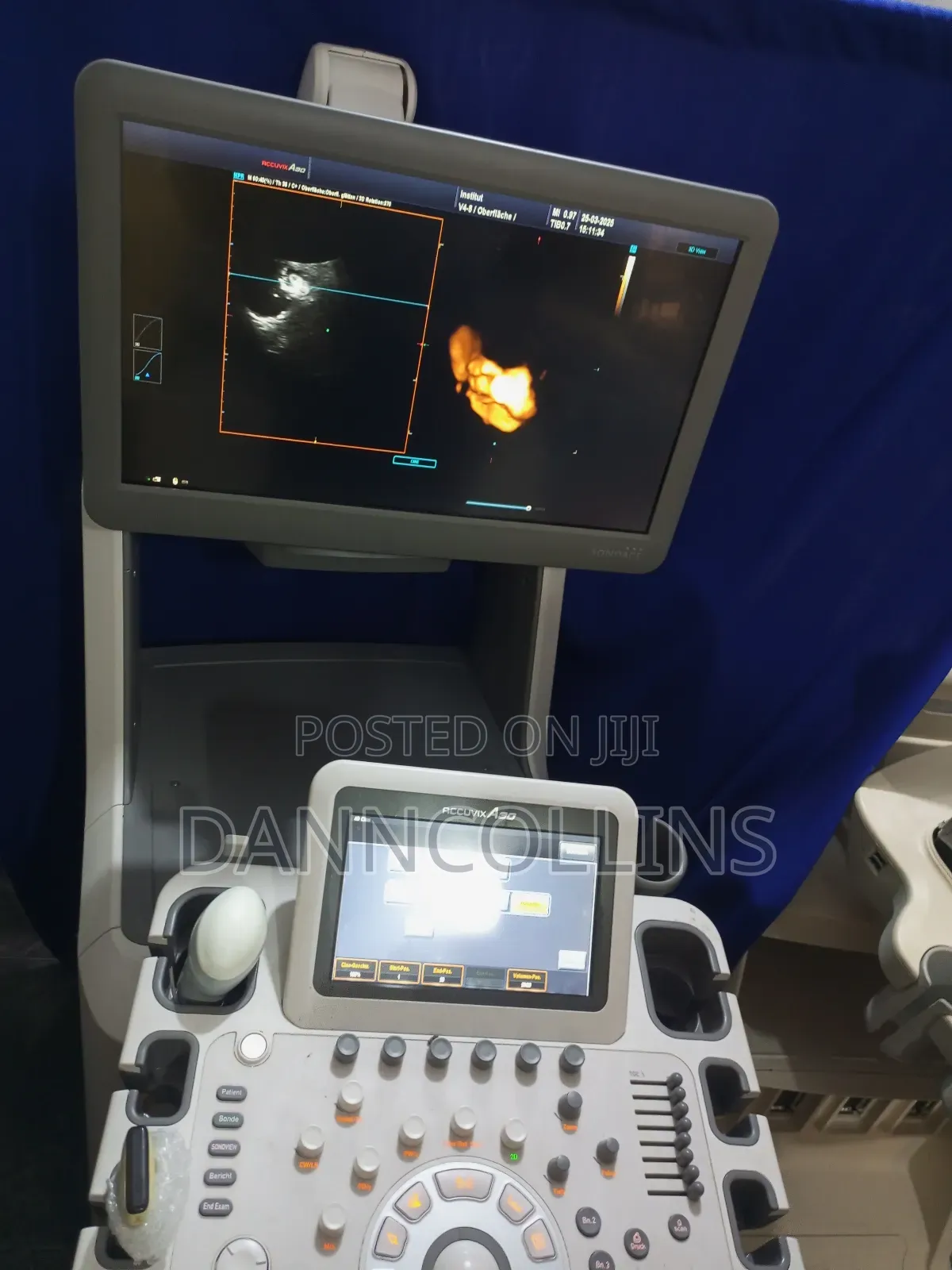 Sonoace Accuvix A30