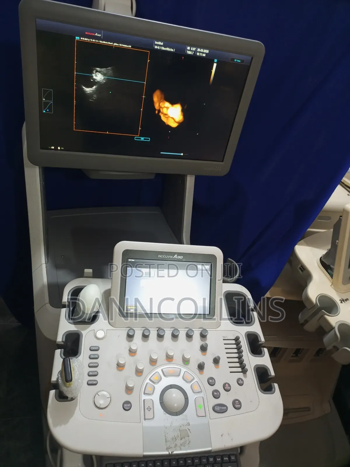 Sonoace Accuvix A30