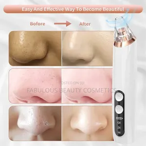 Blackhead Remover, Acne Facial Pore Cleanser Suction Tool