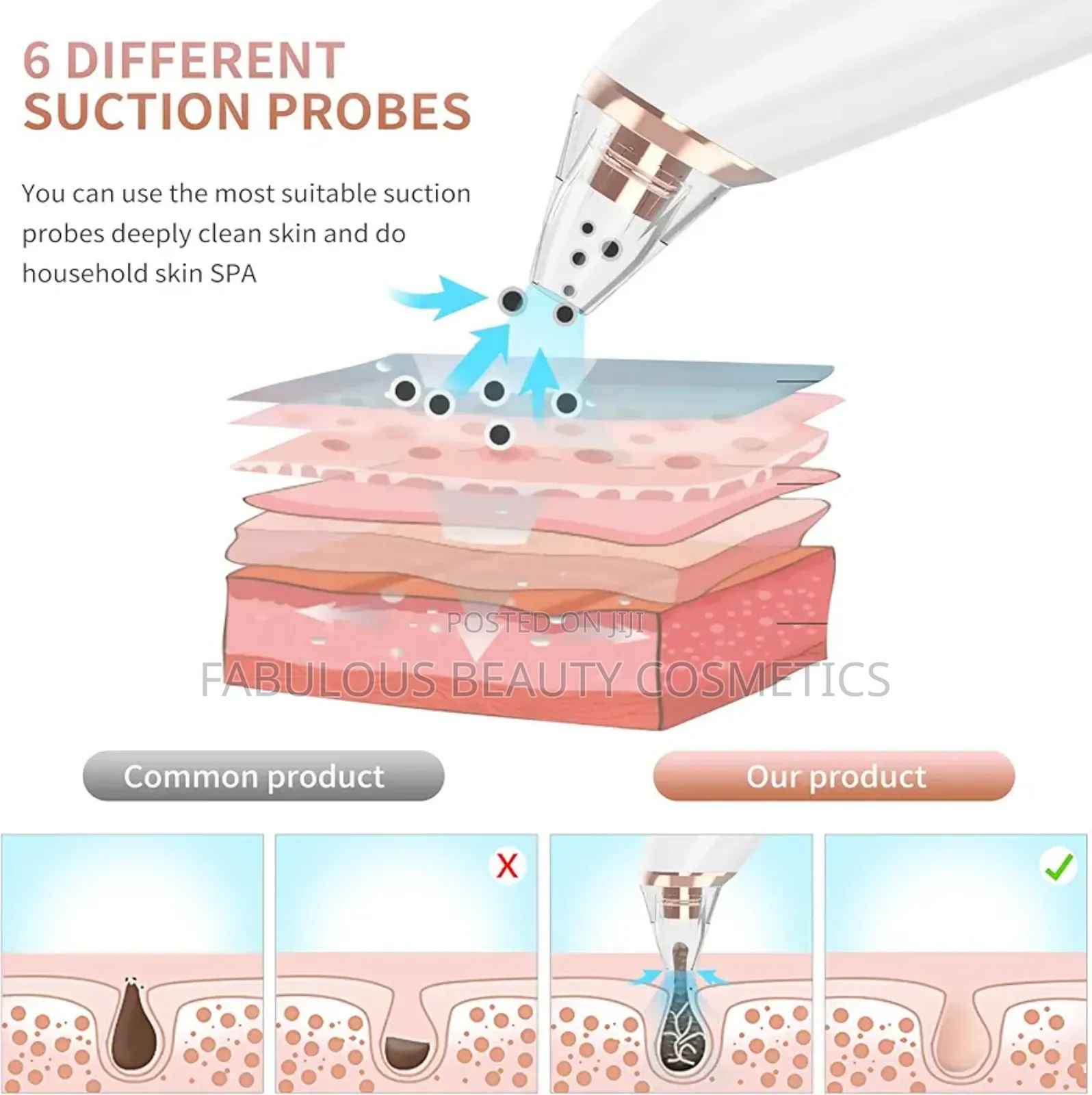 Blackhead Remover, Acne Facial Pore Cleanser Suction Tool
