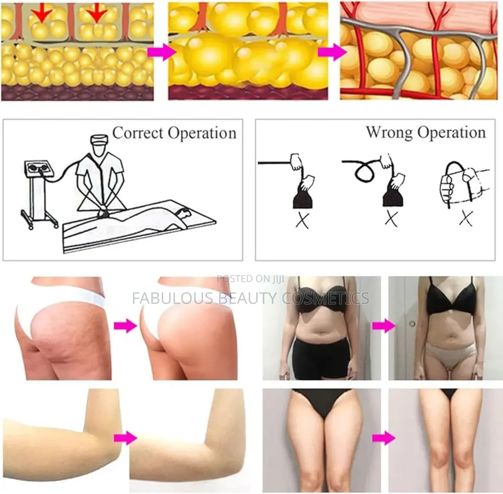 G5 Vibration Body Massager With 5 Massager Heads