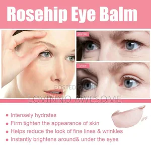 West Month Probiotic Skincare–Diminishing Rose Hip Eye Balm