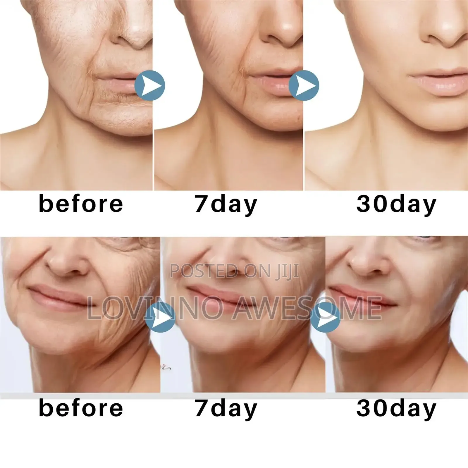 West Month Probiotic Skincare–Diminishing Rose Hip Eye Balm