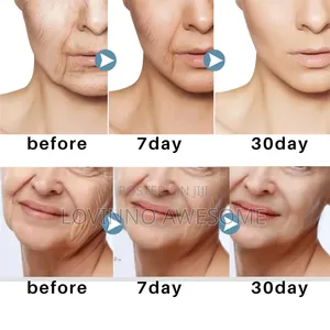 West Month Probiotic Skincare–Diminishing Rose Hip Eye Balm